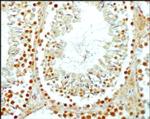 SCP3 Antibody in Immunohistochemistry (Paraffin) (IHC (P))