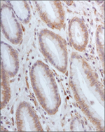 SLC7A11 Antibody in Immunohistochemistry (Paraffin) (IHC (P))