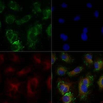 ABCA1 Antibody in Immunocytochemistry (ICC/IF)
