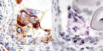 ABCA1 Antibody in Immunohistochemistry (Paraffin) (IHC (P))