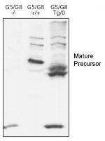 ABCG8 Polyclonal Antibody