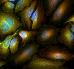 ABCE1 Polyclonal Antibody