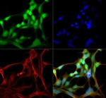 ABCG8 Polyclonal Antibody