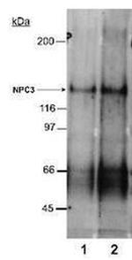 NPC1L1 Antibody in Western Blot (WB)
