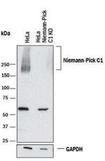 NPC1 Antibody in Western Blot (WB)