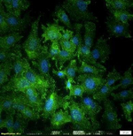 NUMB Polyclonal Antibody