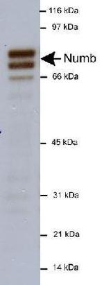 NUMB Antibody in Western Blot (WB)
