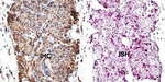 Survivin Antibody in Immunohistochemistry (Paraffin) (IHC (P))