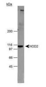 NOD2 Antibody in Western Blot (WB)