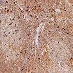 FOXP3 Antibody in Immunohistochemistry (Paraffin) (IHC (P))