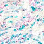 FOXP3 Antibody in Immunohistochemistry (Paraffin) (IHC (P))