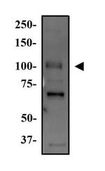 WNK4 Polyclonal Antibody
