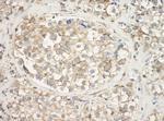 gamma Actin Antibody in Immunohistochemistry (Paraffin) (IHC (P))