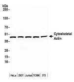gamma Actin Antibody in Western Blot (WB)