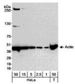 gamma Actin Antibody in Western Blot (WB)