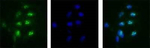 Nucleolin Antibody in Immunocytochemistry (ICC/IF)