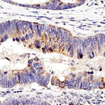 Nucleolin Antibody in Immunohistochemistry (Paraffin) (IHC (P))