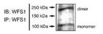 WFS1 Antibody in Immunoprecipitation (IP)