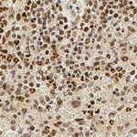 Phospho-IRE1 alpha (Ser724) Polyclonal Antibody