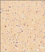 LC3B Polyclonal Antibody