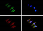 SEMA3B Antibody in Immunocytochemistry (ICC/IF)
