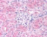 PHD2 Antibody in Immunohistochemistry (Paraffin) (IHC (P))
