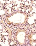 PHD2 Antibody in Immunohistochemistry (Paraffin) (IHC (P))