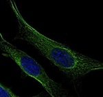 beta Tubulin Antibody in Immunocytochemistry (ICC/IF)