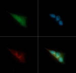 CRYAB Polyclonal Antibody