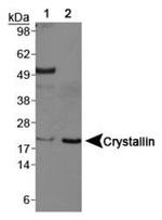 CRYAB Antibody in Western Blot (WB)
