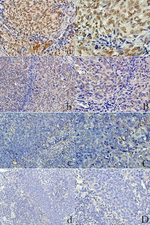LOX Antibody in Immunohistochemistry (Paraffin) (IHC (P))