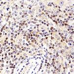 SPDYA Polyclonal Antibody