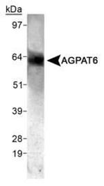 AGPAT6 Antibody in Western Blot (WB)