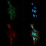CERK Polyclonal Antibody