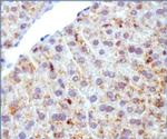 ADFP Antibody in Immunohistochemistry (IHC)