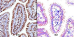 ADFP Antibody in Immunohistochemistry (Paraffin) (IHC (P))