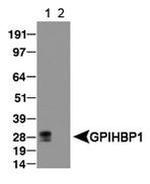 GPIHBP1 Antibody in Western Blot (WB)