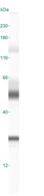 CGI58 Polyclonal Antibody