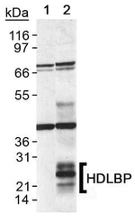 GPIHBP1 Polyclonal Antibody