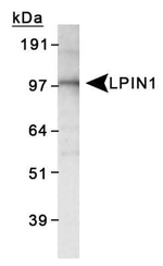 LPIN1 Antibody in Western Blot (WB)