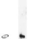 Decorin Antibody in Western Blot (WB)
