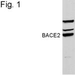 BACE2 Antibody in Western Blot (WB)