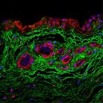 ITIH1 Antibody in Immunohistochemistry (Paraffin) (IHC (P))