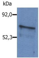 BLNK Polyclonal Antibody