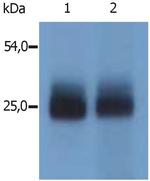 NTAL Polyclonal Antibody