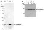 Galectin 7 Antibody in Western Blot (WB)