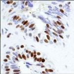 TRIM28 Antibody in Immunohistochemistry (Paraffin) (IHC (P))