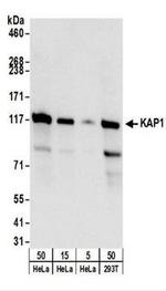 TRIM28 Antibody in Western Blot (WB)