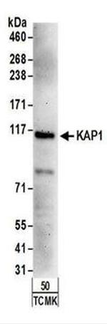 TRIM28 Antibody in Western Blot (WB)