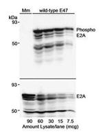 Phospho-TCF3 (Thr355) Antibody in Western Blot (WB)